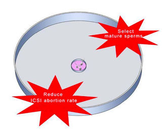 Hyaluronic Zure Schotel van de Spermaselectie voor ICSI IVF verlaagt het Tarief van het Zwangerschapsverlies