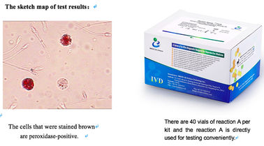 Sperma Monster Leukocyten Test Kit 40T/Kit Voor Screening Mannelijke Voortplantingsstelsel Infectie