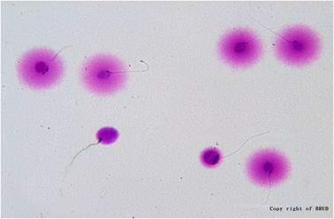 BRED Sperm DNA Fragmentatie Test Kit 24 maanden houdbaarheid