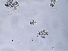 BRENG IgA Test Kit IgA Antibody Coating Spermatozoa IN DE WAR BRENGEN in de war de Testuitrusting van de Spermafunctie
