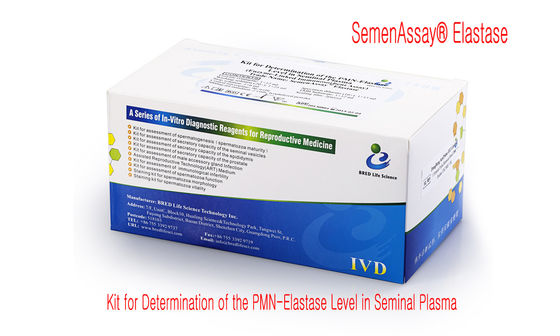 De economische van de de Fragmentatietest van Spermadna Bepaling van het de Fragmentatieniveau van DNA van Kit For--spermachromatin verspreidingsmethode