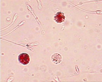 Eenvoudig te bedienen mannen-vruchtbaarheidstestkit Sperma leukocyten-testkit Peroxidase-kleuring
